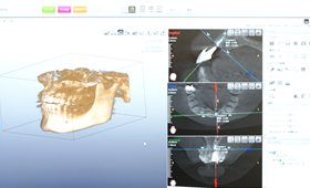 歯科用CTスキャナー画像2 